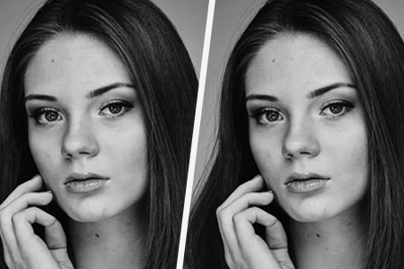 Before and after treatment image